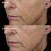 biotech-longevity-creme-Subject-11 IMAGE MD Biotech крем