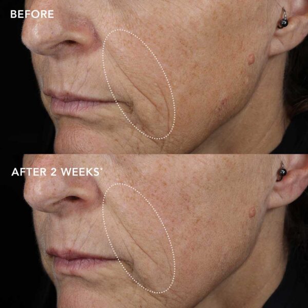 biotech-longevity-creme-Subject-11 IMAGE MD Biotech крем
