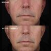 biotech-longevity-creme-Subject-4 IMAGE MD Biotech крем