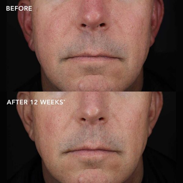 biotech-longevity-creme-Subject-4 IMAGE MD Biotech крем