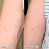 imageskincare-volulift-body-before-after1.jpg VOL.U.LIFT™ BODY nostiprinošs ķermeņa krēms