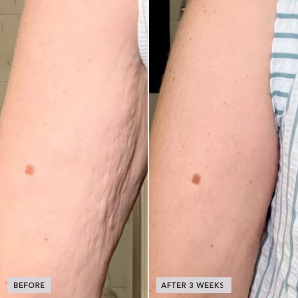 imageskincare-volulift-body-before-after1.jpg VOL.U.LIFT™ BODY nostiprinošs ķermeņa krēms