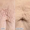 imageskincare-volulift-body-before-after2.jpg VOL.U.LIFT™ BODY nostiprinošs ķermeņa krēms
